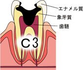 根幹のイラスト